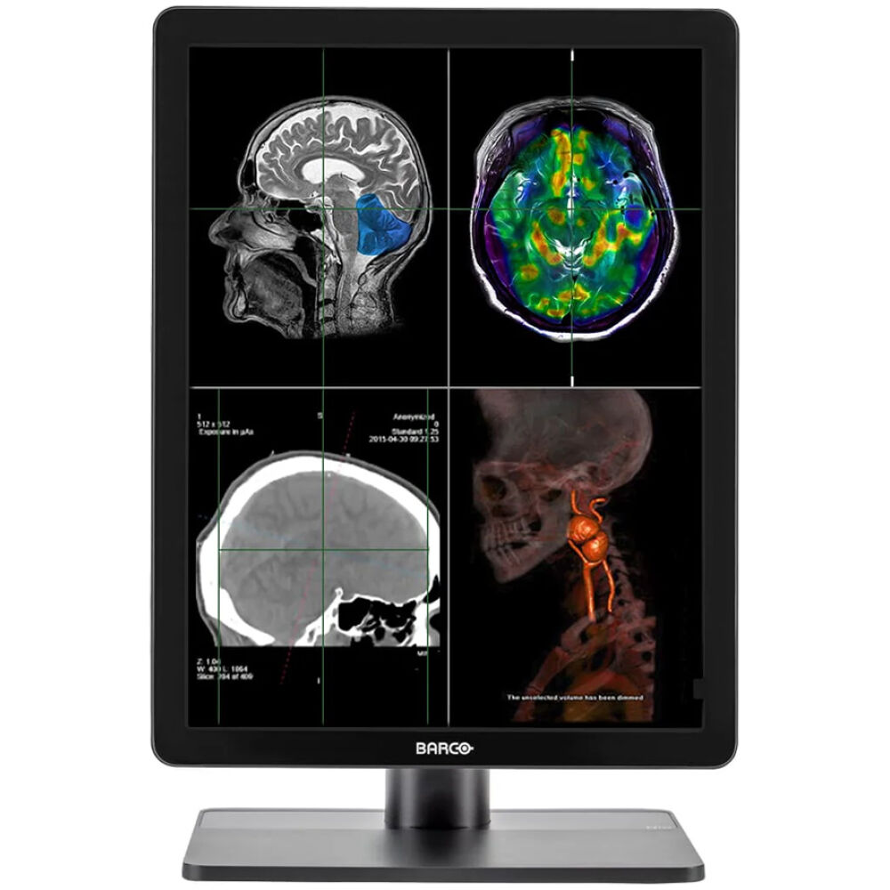 BARCO used οθόνη MDNC-2221 IPS-PRO, 21.3", 1600x1200, Diagnostic Radiology Display, DVI/DisplayPort, Grade B